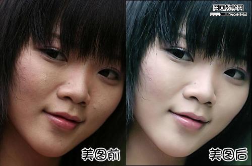 ���˶����۰�Ƥ�� ��ͼ����һ��ĥƤϸ���÷� 